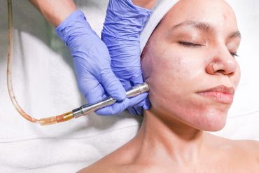 Le meilleur nettoyeur de pores électrique